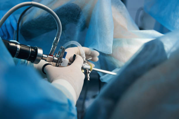 Laparoscopic Surgeries Services